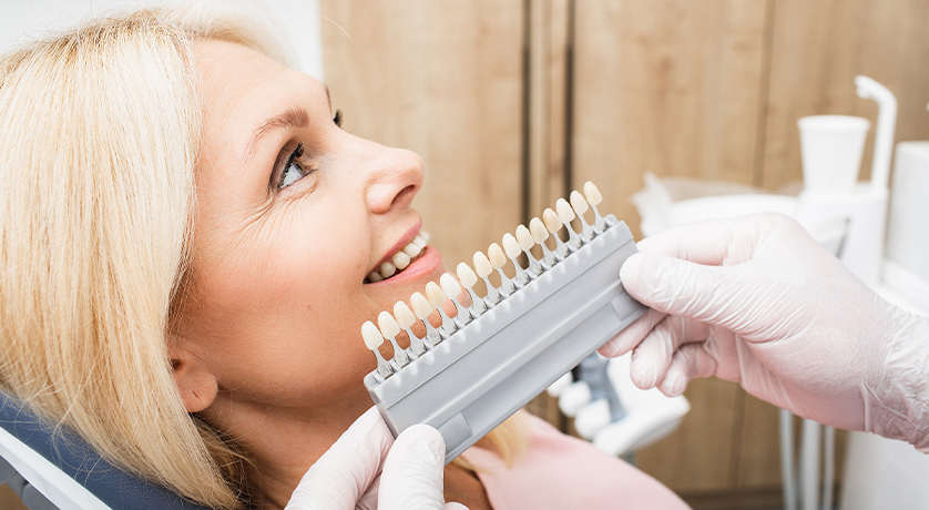 Dental Veneers