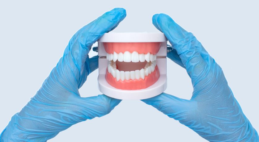 How Many Years Can I Expect My Partial Dentures to Last Before Needing a Replacement?