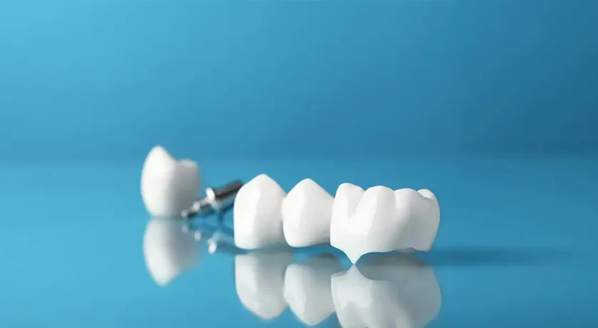 Can You Eat Normally With a Dental Crown in Boynton Beach, FL?