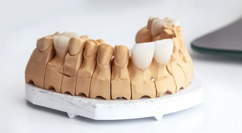 Can Dental Veneers Correct Slightly Uneven Teeth?